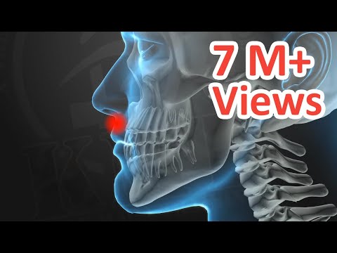 KRAV MAGA TRAINING • Knockout Pressure Points (part 1 of 5)