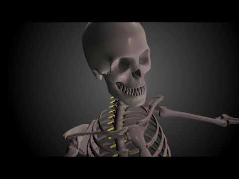 how to diagnose csf leak