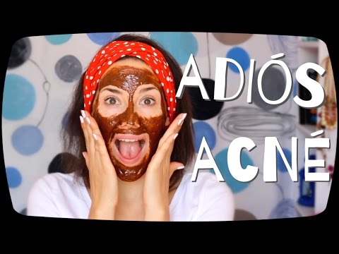 Como eliminar el acne