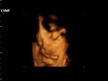 Achilles Mikhail 4D Ultrasound Achilles Mikhail 4D Ultrasound