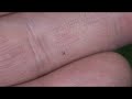Slap & Tickle - a little tick nymph Slap & Tickle - a little tick nymph