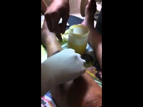 See video