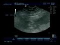 mi bebe 15 semanas
