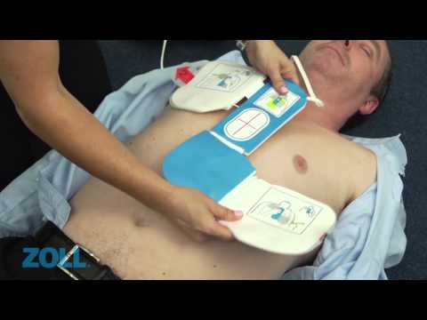 CPR Defibrillator - Real Time Dituation Demonstration