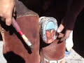 Laminitis Founder Treatment