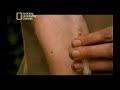 Drogas Heroína y Cocaína 2 Drogas Heroína y Cocaína 2