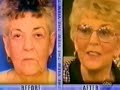 Dr. Grossman on \"The View\" Part 2 Discussing Face Lift Dr. Grossman on \"The View\" Part 2 Discussing Face Lift