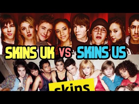SKINS UK vs SKINS US ¿Cuál es mejor?