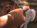 USARPAC - U.S. Army - DENTAL - Philippines USARPAC - U.S. Army - DENTAL - Philippines