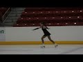 Down syndrome:&nbsp;Down Syndrome Lauren Miller