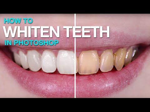 how to whiten teeth in ps