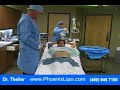 liposuction Dr. Theiler - Holly