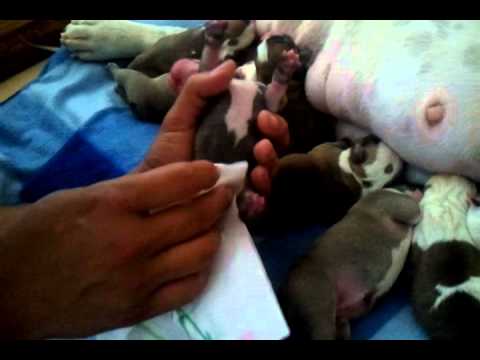 how to care after c section