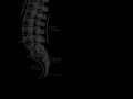 Lower Back Pain Information Lower Back Pain Information