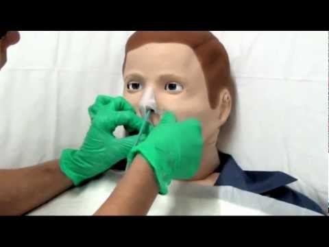 SNG - Procedura per il posizionamento di un sondino naso gastrico (SNG)