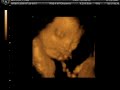 Baby Adcock 4d