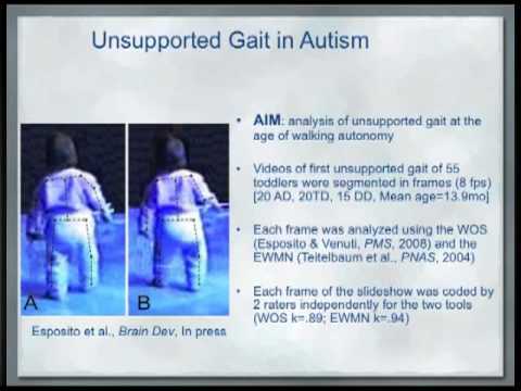 (ENG) Development of unsupported gait in children with Autism