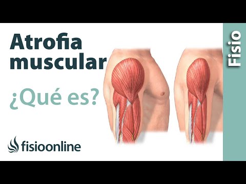 Atrofia muscular - Qué es y cómo sucede