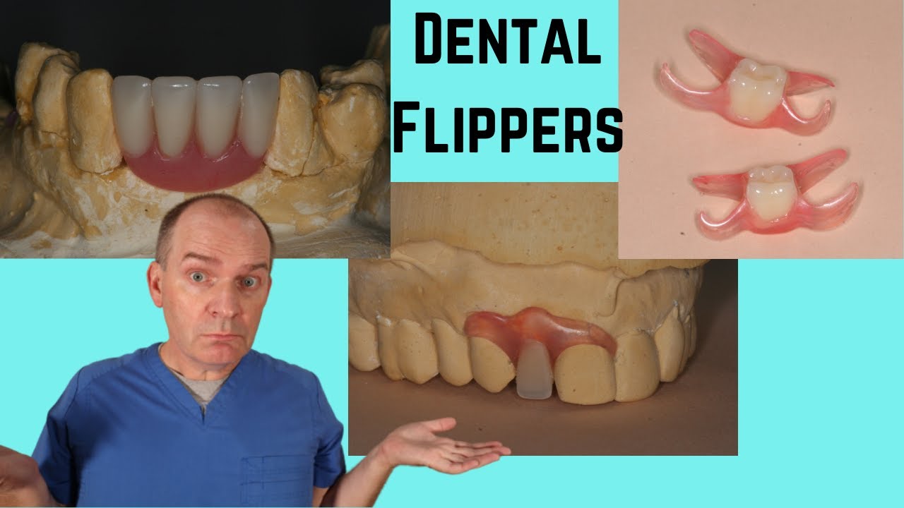 Dental Flipper vs Partial Denture Peridot Dental Care