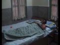 guillain barre syndrome