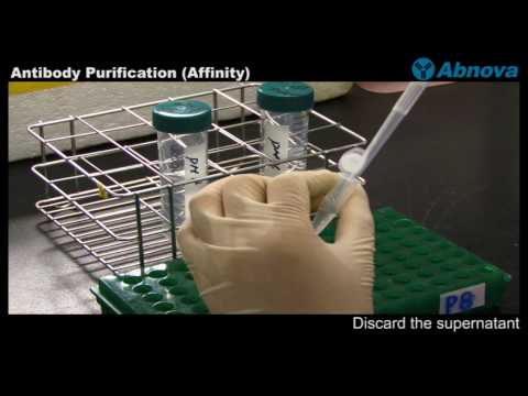 how to isolate and purify esters