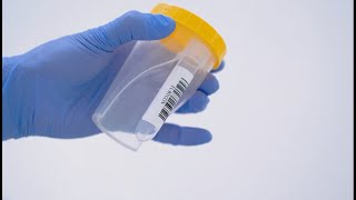 video thumbnail TUBYCON Urine Collection Tube Kit youtube