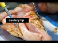 Laser vs Cautery Labiaplasty