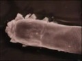 You have life form living on our body