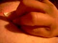 Popping a huge Zit