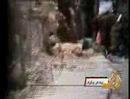 A Blinded Palastenian Young Man Shot