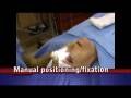 Browplasty (brow lift) with radiofrequency neuroablation and bioadhesive fixation