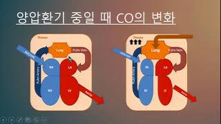 Advanced course - Hemodynamic monitoring - 울산의대 최욱진 교수님