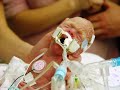 Micro-Preemie Awareness Micro-Preemie Awareness