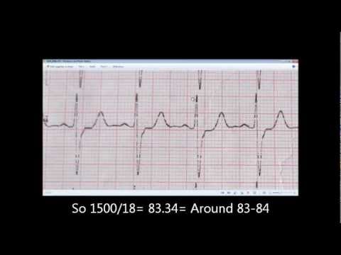 how to measure rr interval