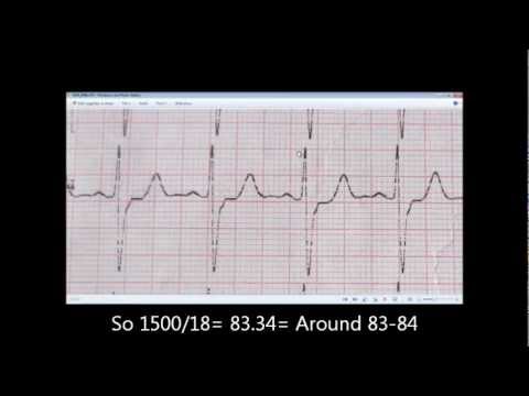 how to measure the p-r interval