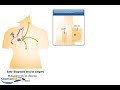 Breast cancer surgery: Modified Mastectomy