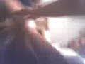 depilator al atake 2