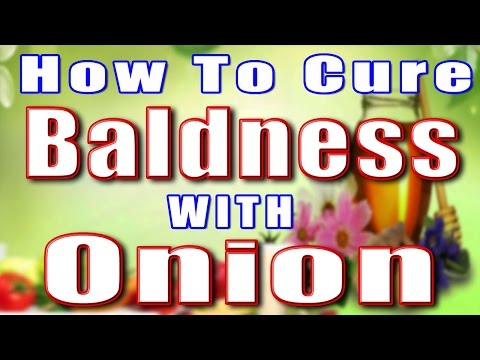 how to cure baldness