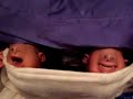 Chin Puppets