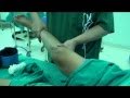 Posterior Cruciate Ligament Trauma Exams (Reverse Pivot Shift Exam)