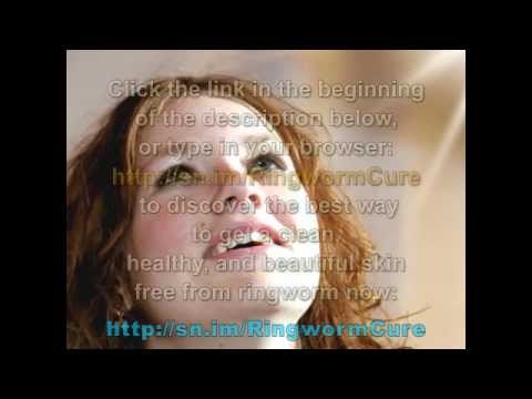 how to get rid of crotch fungus