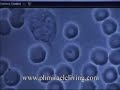 live blood cell analysis dr. Robert Young