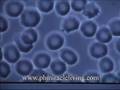 live blood cell analysis dr. Robert Young