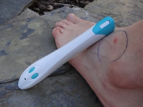 HILFE GEGEN MÜCKENSTICHE! - SELBST TEST [Bite Away Cobra Stichheiler]  -Heilt Schnell & Effektiv