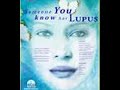 faces-of-lupus.html