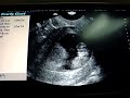Mi bebe saluda