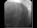 M. K. Malik Angiography 2