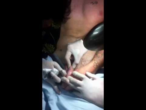 Penise Piercing Mi Dovme Mi Inci Sozluk Penise Piercing Mi Dovme Mi Inci Sozluk