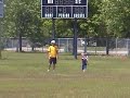 Broken Hand, and The Little Forehand Kid Broken Hand, and The Little Forehand Kid