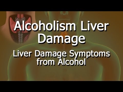 Alcoholism Liver Damage